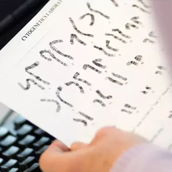 Torch Panel Avidity, IgG